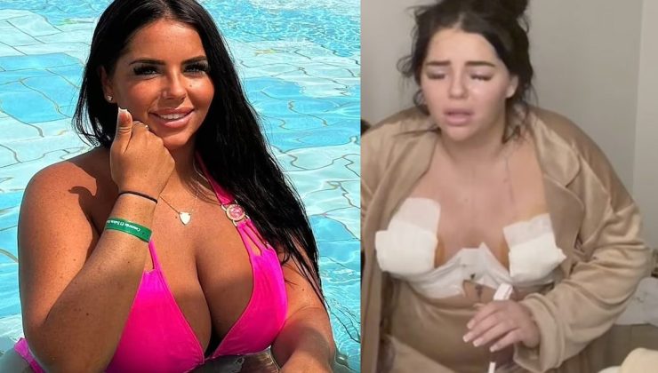 İngiltere ve Türkiye arasındaki estetik krizi büyüyor… Bir vaka daha…