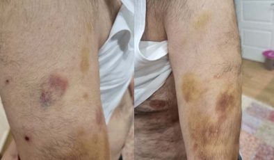 Eli ‘sopalı’ öğretmen! İstanbul’da otizmli öğrenciye şiddet