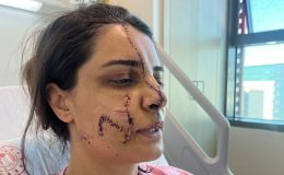 Bıçakla saldırıp yüzünü ikiye bölmüştü! Ağaçta taciz etmiş