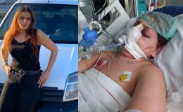 Estetik ameliyatı oldu, 5 gün sonra öldü