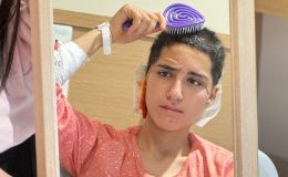 Kafa derisi kopan Dilara aynayla barıştı