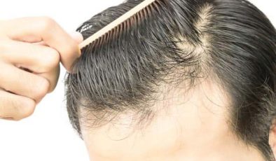 Kök Hücre Saç Ekimi – Cerrahi Tedavi Yöntemleri