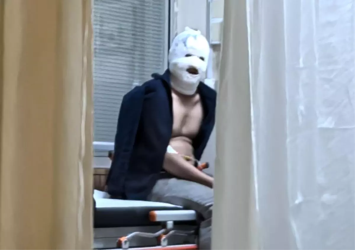 Benzinle Sobayı Tutuştururken Yüzünden Yaralanan Genç Hastaneye Kaldırıldı